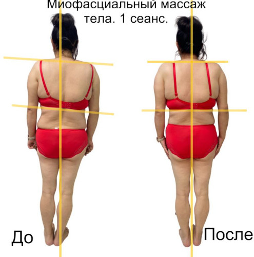 Миофасциальный массаж. Что это такое, для чего нужен