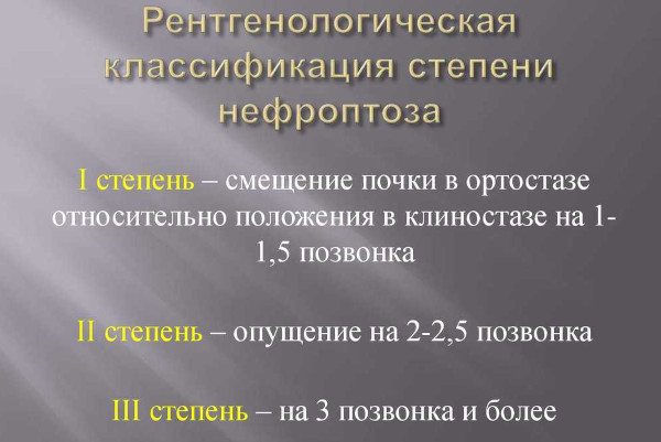 Нефроптоз (опущение почки). Что это такое, симптомы, лечение, как исправить