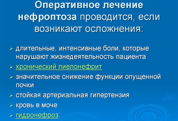 Нефроптоз (опущение почки). Что это такое, симптомы, лечение, как исправить