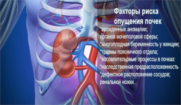 Нефроптоз (опущение почки). Что это такое, симптомы, лечение, как исправить