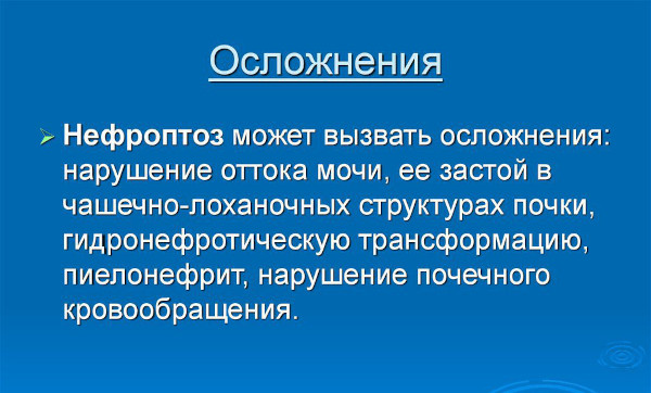 Нефроптоз (опущение почки). Что это такое, симптомы, лечение, как исправить