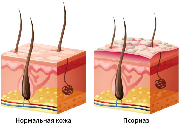 Озонированное масло. Применение, цена, отзывы