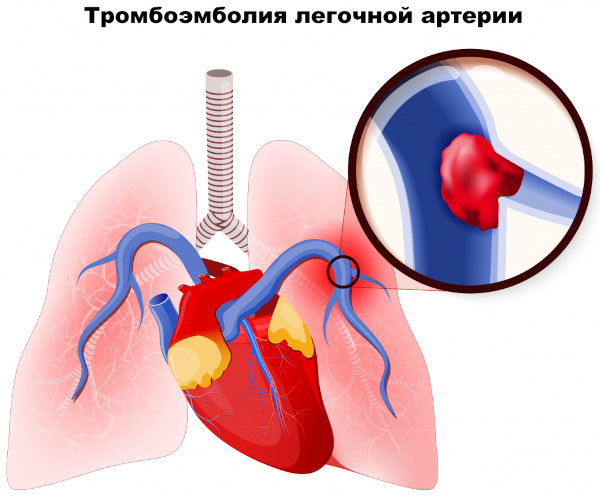 Ривароксабан (Rivaroxaban) таблетки. Инструкция по применению