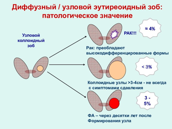 Узловой зоб щитовидной железы у взрослых. Клинические рекомендации