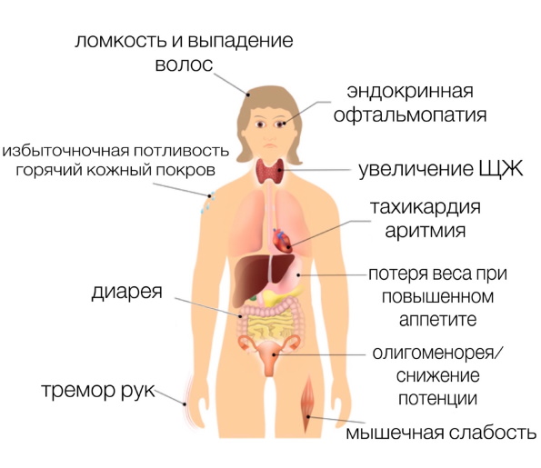 Узловой зоб щитовидной железы у взрослых. Клинические рекомендации