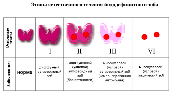 Узловой зоб щитовидной железы у взрослых. Клинические рекомендации