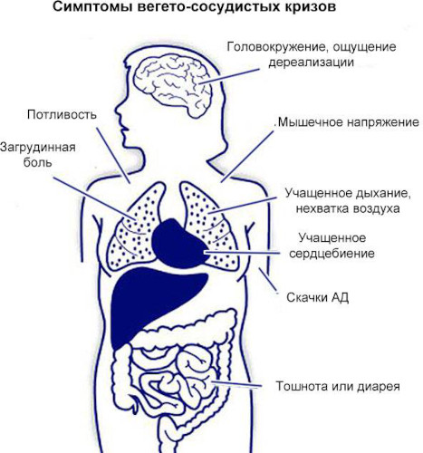 Вегетативный криз. Что это такое, симптомы, лечение