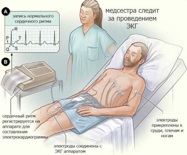 Вегетативный криз. Что это такое, симптомы, лечение