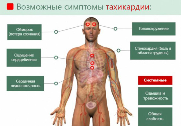 Воронкообразная грудная клетка у ребенка. Причины, фото