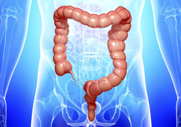 Воспалительные заболевания толстого кишечника. Симптомы, лечение