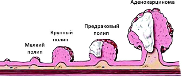 Заболевания матки у женщин. Виды, симптомы, названия