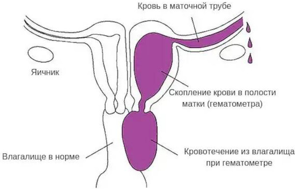 Заболевания матки у женщин. Виды, симптомы, названия