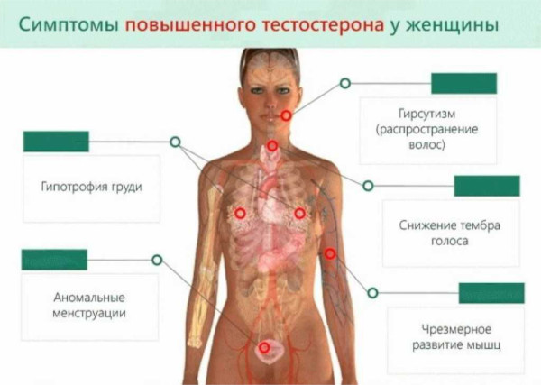 Гиперандрогения у женщин. Что это, симптомы, лечение