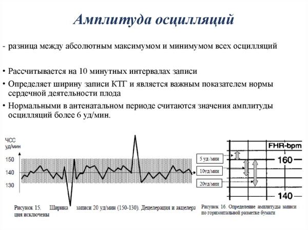 КТГ при беременности (кардиотокография плода). Сколько длится, как, когда делают