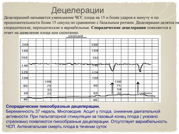 КТГ при беременности (кардиотокография плода). Сколько длится, как, когда делают