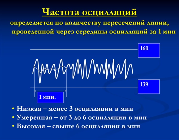 КТГ при беременности (кардиотокография плода). Сколько длится, как, когда делают