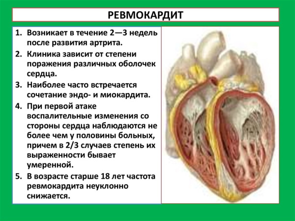 Митральная конфигурация сердца. Рентгенограмма, что это, характеристика