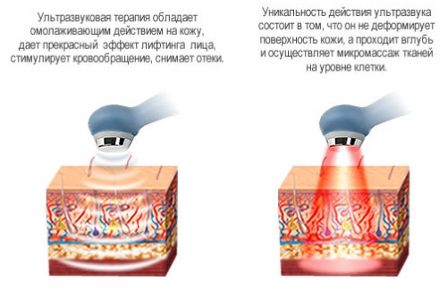 Нарушение статики шейного отдела позвоночника, поясничного, пояснично-крестцового, грудного