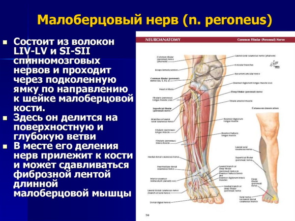 Невропатия (неврит) малоберцового нерва. Симптомы, лечение