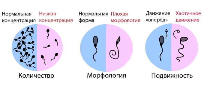 Отсутствие эякуляции (нет спермы, не выделяется). Лечение аспермии у мужчин