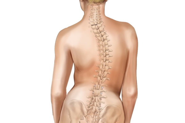 Правосторонний сколиоз грудного отдела позвоночника 1-2 степени