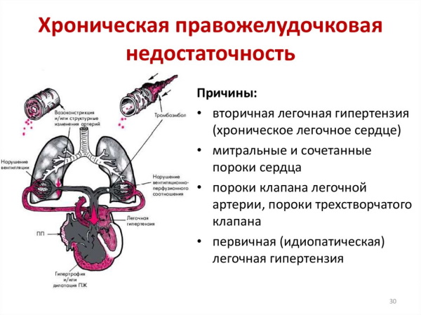 Признаки сердечной недостаточности. Симптомы у женщин, мужчин