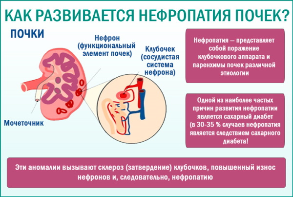 Признаки сердечной недостаточности. Симптомы у женщин, мужчин