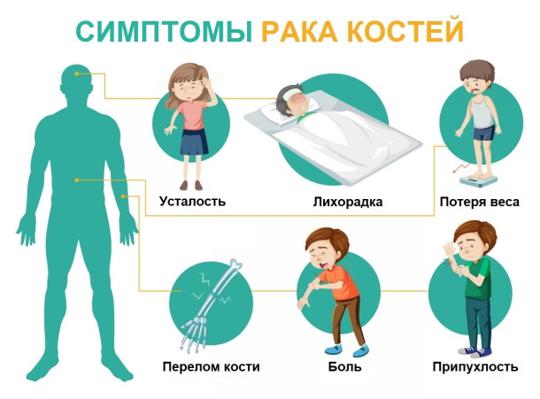 Смещение позвонков грудного отдела. Симптомы, лечение, упражнения