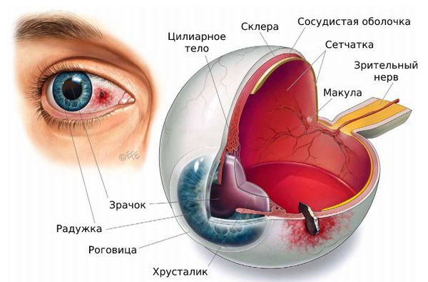 Ушиб (травма) глаза. Первая помощь, классификация, лечение