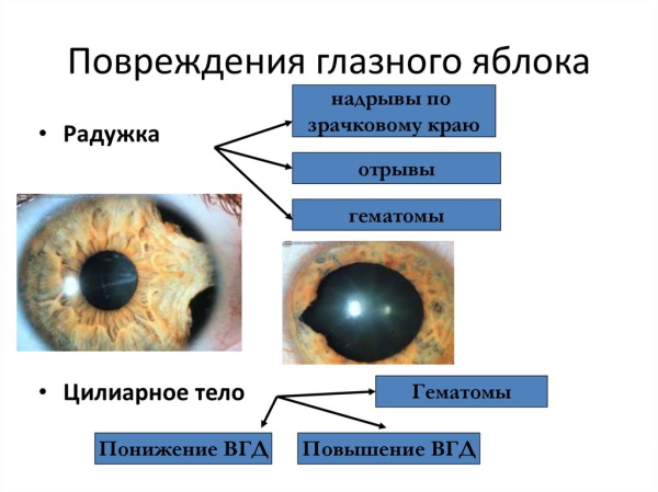 Ушиб (травма) глаза. Первая помощь, классификация, лечение