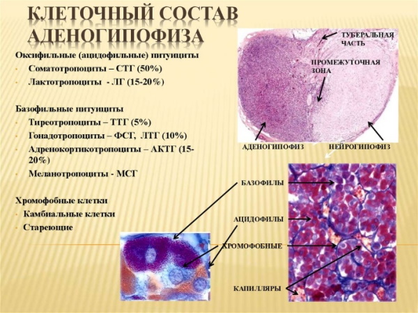 Аденома гипофиза. Симптомы, что это такое, прогноз