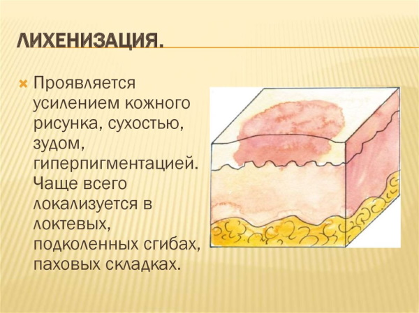 Кандидозный кольпит (вагинит). Лечение у женщин, клинические рекомендации