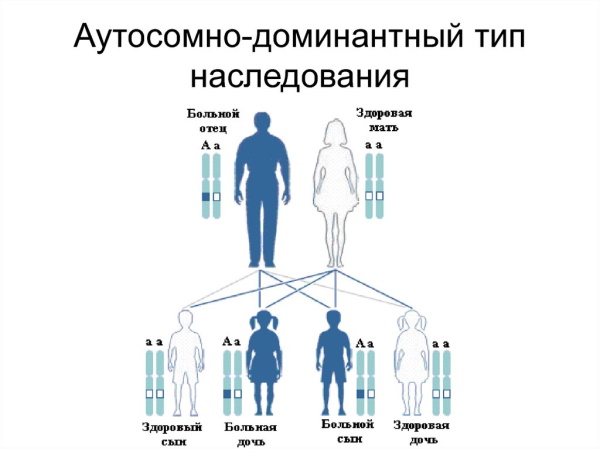 Остеопетроз что за болезнь у детей. Симптомы и лечение