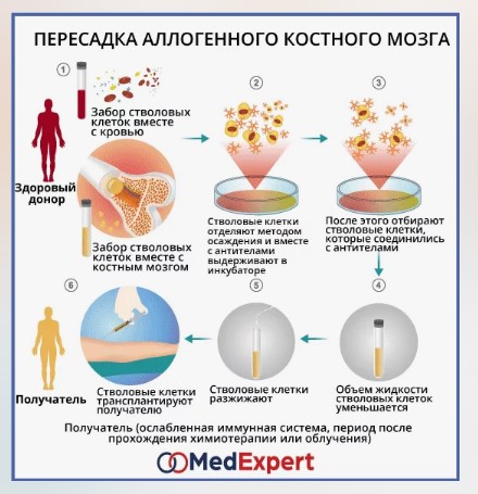 Остеопетроз что за болезнь у детей. Симптомы и лечение