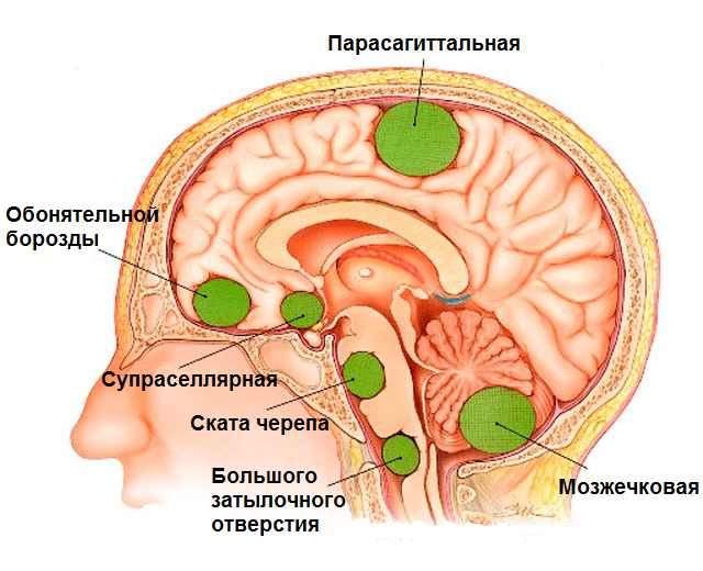 Шаткость (шаткая походка). Причины, лечение в пожилом возрасте